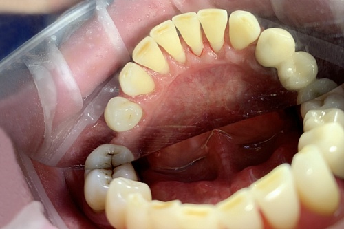 Био-гигиена полости рта с натуральным комплексом солей «Мертвого моря»